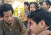 Salah masa aksi Forum Pribumi Mengugat yang mengalami luka di kepala. Foto : Redaksi 